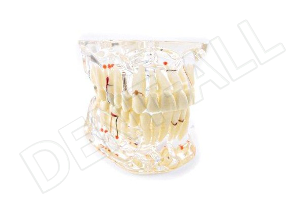 Modelo Didactico Transparente Meta Dental