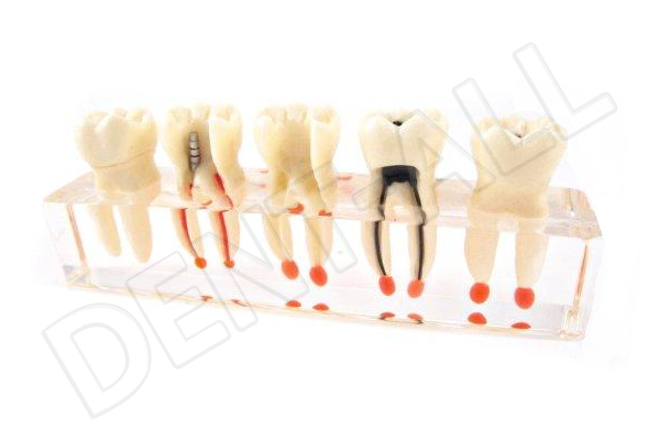 Modelo Didactico de Muelas Transparente Meta Dental